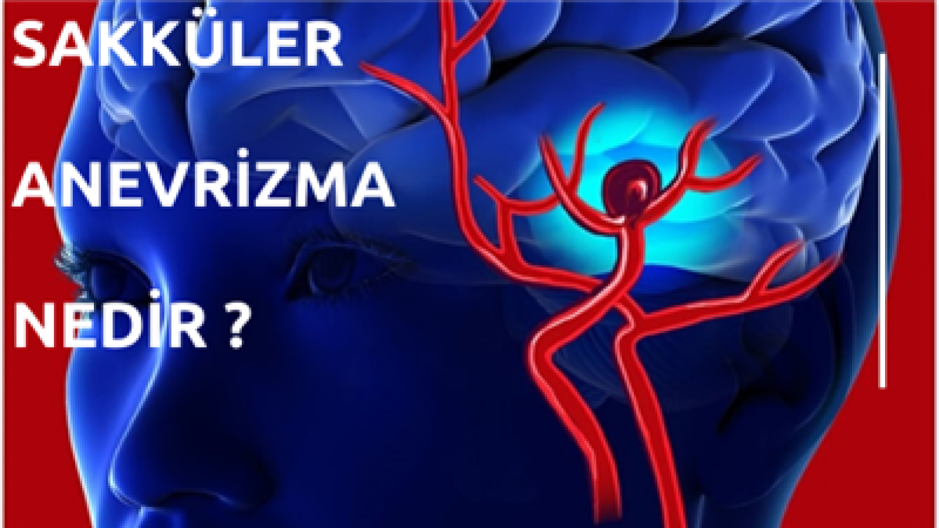 SAKKÜLER ANEVRİZMA NEDİR ?