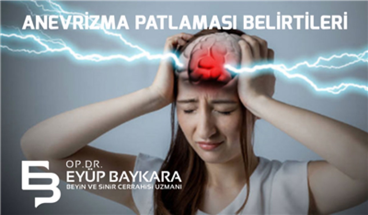 ANEVRİZMA PATLAMASI BELİRTİLERİ