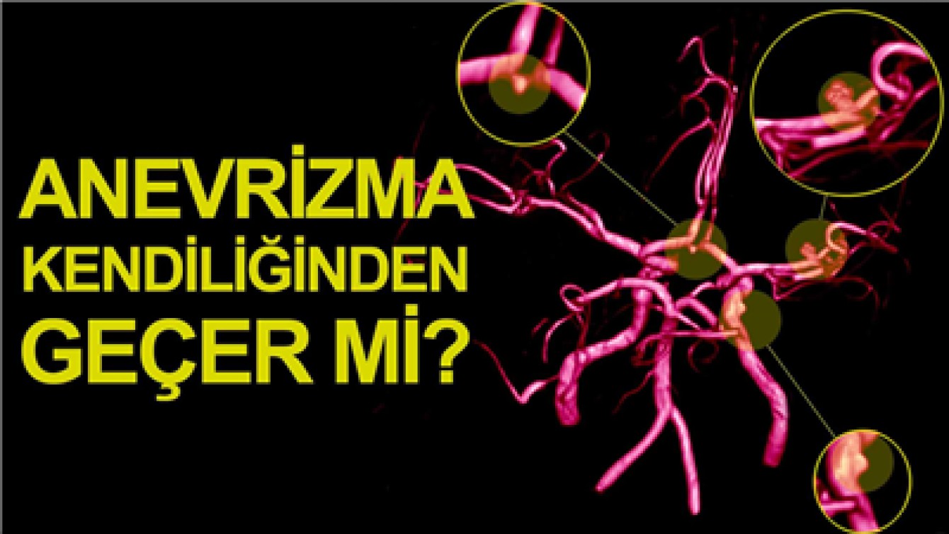BEYİNDEKİ BALONCUK KENDİLİĞİNDEN GEÇER Mİ?