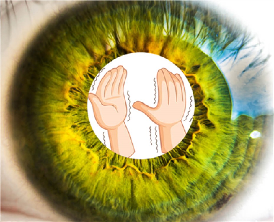 PARKİNSON HASTALIĞI GÖZLERİ ETKİLEYEBİLİR