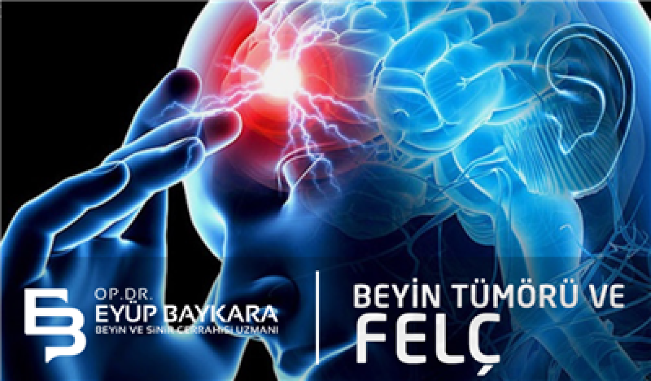 BEYİN TÜMÖRÜ VE FELÇ