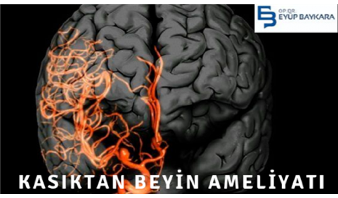 KASIKTAN BEYİN AMELİYATI