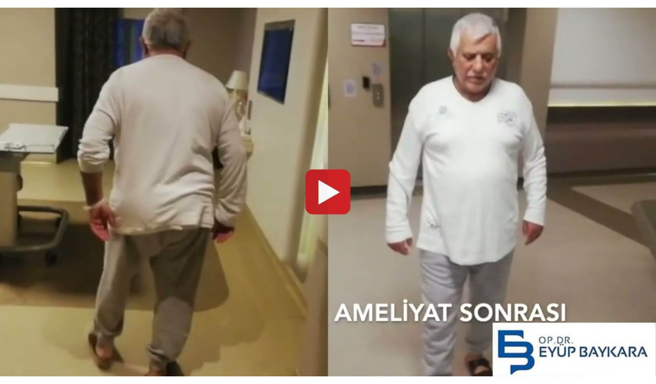 OMURGA KANAL DARALMASINA NE İYİ GELİR?