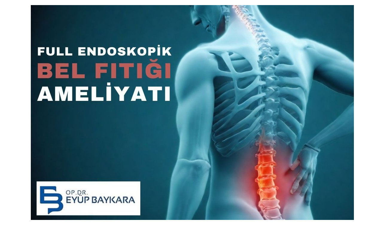 FULL ENDOSKOPİK BEL FITIĞI AMELİYATI