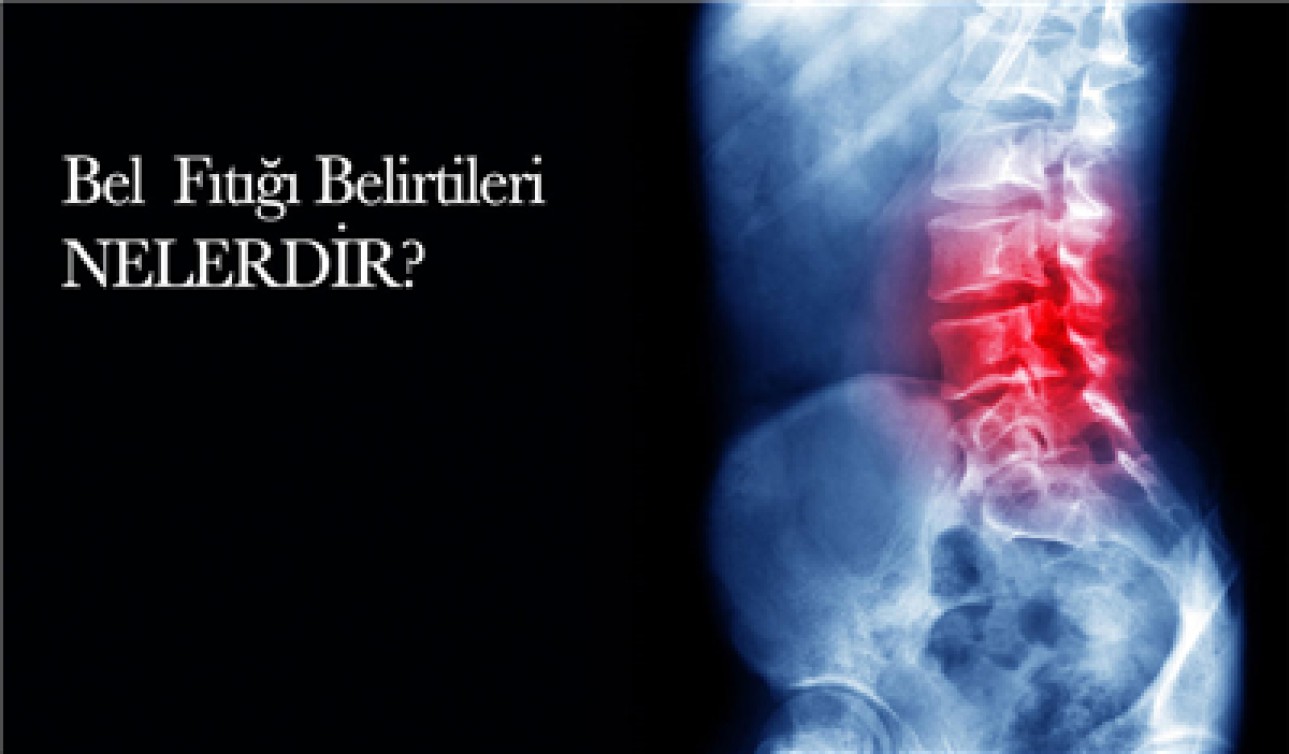 BEL FITIĞI BELİRTİLERİ NELERDİR?