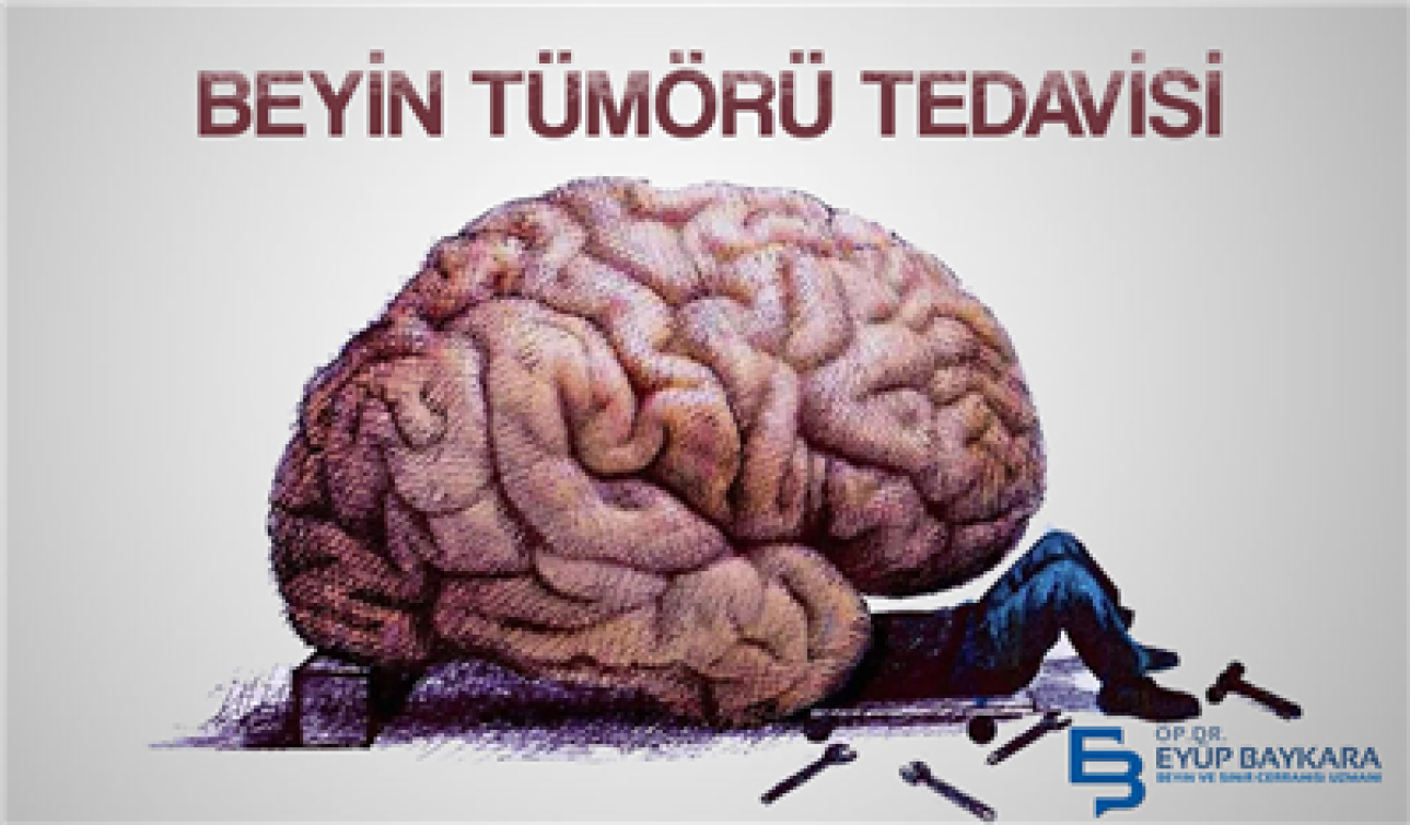 BEYİN TÜMÖRÜ TEDAVİSİ