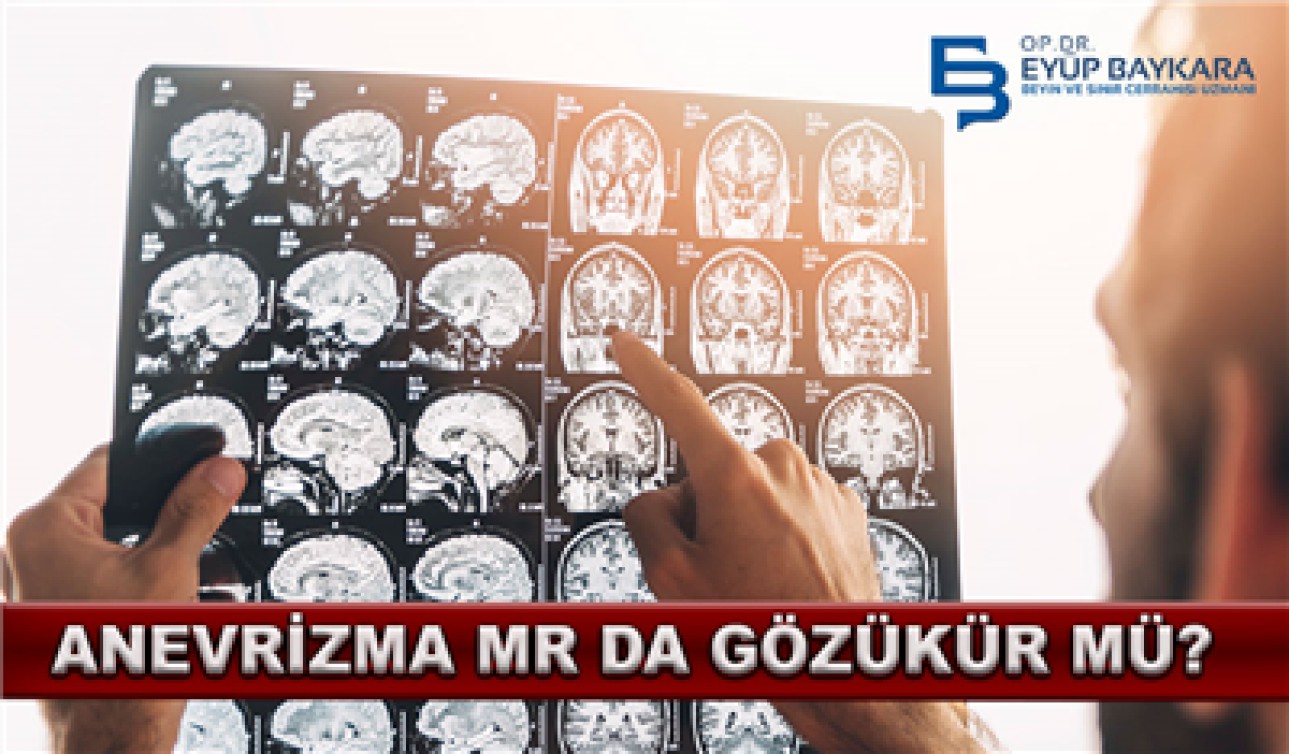 ANEVRİZMA MR.DA GÖRÜNÜR MÜ ?
